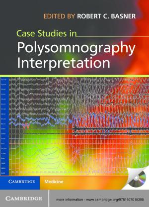 Cover of Case Studies in Polysomnography Interpretation