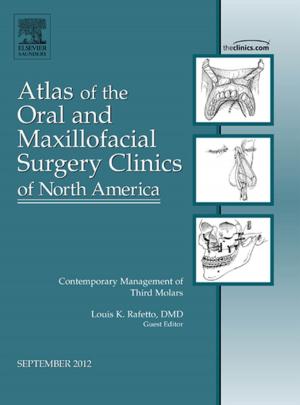 Cover of the book Contemporary Management of Third Molars, An Issue of Atlas of the Oral and Maxillofacial Surgery Clinics by Giovanni De Domenico, Grad Dip(Physiotherapy), Dip TP, MSc, PhD, MCSP, MAPA, MCPA
