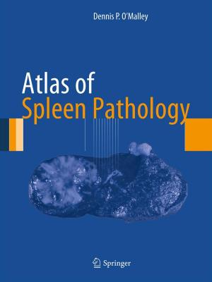 Cover of the book Atlas of Spleen Pathology by Valérie Guillard, Nathalie Gontard, Claire Bourlieu