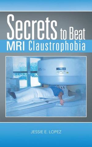 Book cover of Secrets to Beat Mri Claustrophobia