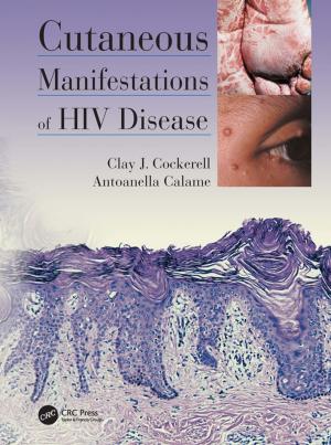 Cover of the book Cutaneous Manifestations of HIV Disease by Michael W. Carter, Camille C. Price