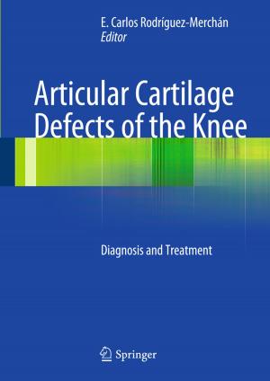 Cover of the book Articular Cartilage Defects of the Knee by Michele Cini, Francesco Fucito, Mauro Sbragaglia