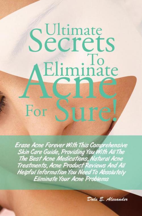 Cover of the book Ultimate Secrets To Eliminate Acne For Sure! by Dale E. Alexander, KMS Publishing