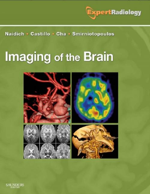 Cover of the book Imaging of the Brain E-Book by Thomas P. Naidich, MD, Mauricio Castillo, MD, Soonmee Cha, MD, James G. Smirniotopoulos, MD, Elsevier Health Sciences