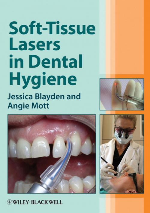Cover of the book Soft-Tissue Lasers in Dental Hygiene by Jessica Blayden, Angie Mott, Wiley