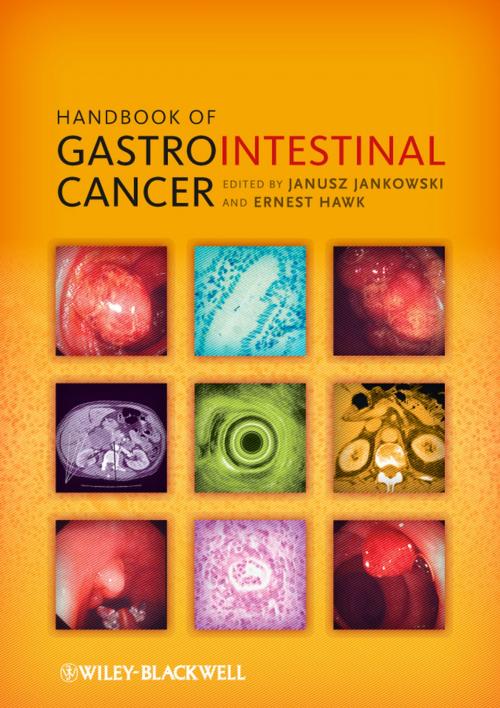 Cover of the book Handbook of Gastrointestinal Cancer by , Wiley
