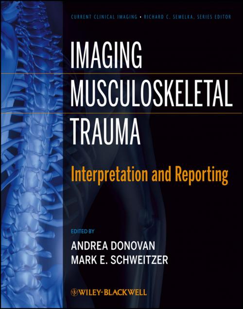Cover of the book Imaging Musculoskeletal Trauma by , Wiley