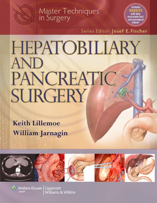 Cover of the book Master Techniques in Surgery: Hepatobiliary and Pancreatic Surgery by Keith Lillemoe, William Jarnagin, Wolters Kluwer Health