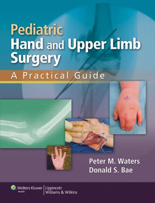 Cover of the book Pediatric Hand and Upper Limb Surgery by Peter M. Waters, Donald S. Bae, Wolters Kluwer Health