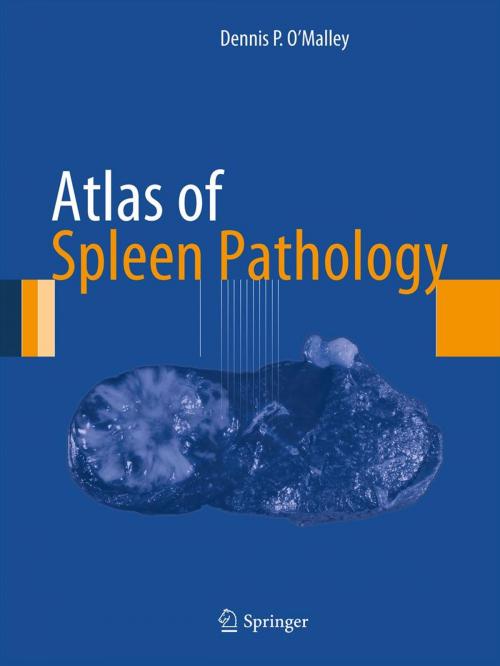 Cover of the book Atlas of Spleen Pathology by Dennis P. O'Malley, Springer New York
