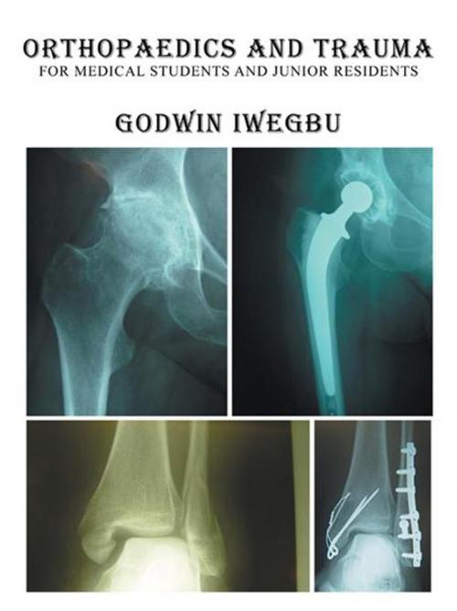 Cover of the book Orthopaedics and Trauma for Medical Students and Junior Residents by Godwin Iwegbu, AuthorHouse