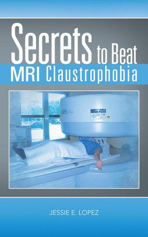Cover of the book Secrets to Beat Mri Claustrophobia by Jessie E. Lopez, AuthorHouse