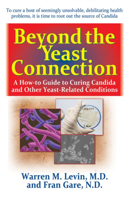 Cover of the book Beyond the Yeast Connection by Warren M. Levin, M.D., Fran Gare, N.D., Turner Publishing Company