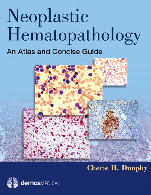 Cover of the book Neoplastic Hematopathology by Cherie H. Dunphy, MD, Springer Publishing Company