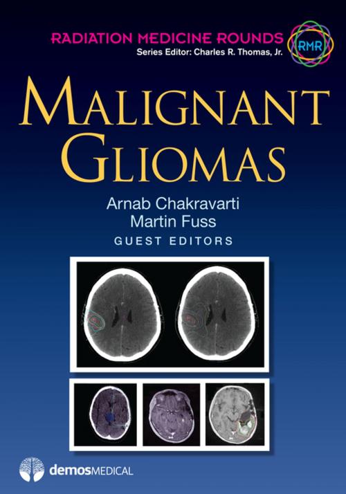 Cover of the book Malignant Gliomas by Arnab Chakravarti, MD, Martin Fuss, MD, Charles R. Thomas Jr., MD, Springer Publishing Company