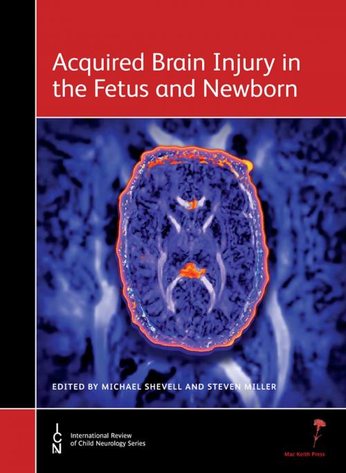 Cover of the book Acquired Brain Injury in the Fetus and Newborn by Michael Shevell, Steven Miller, Mac Keith Press