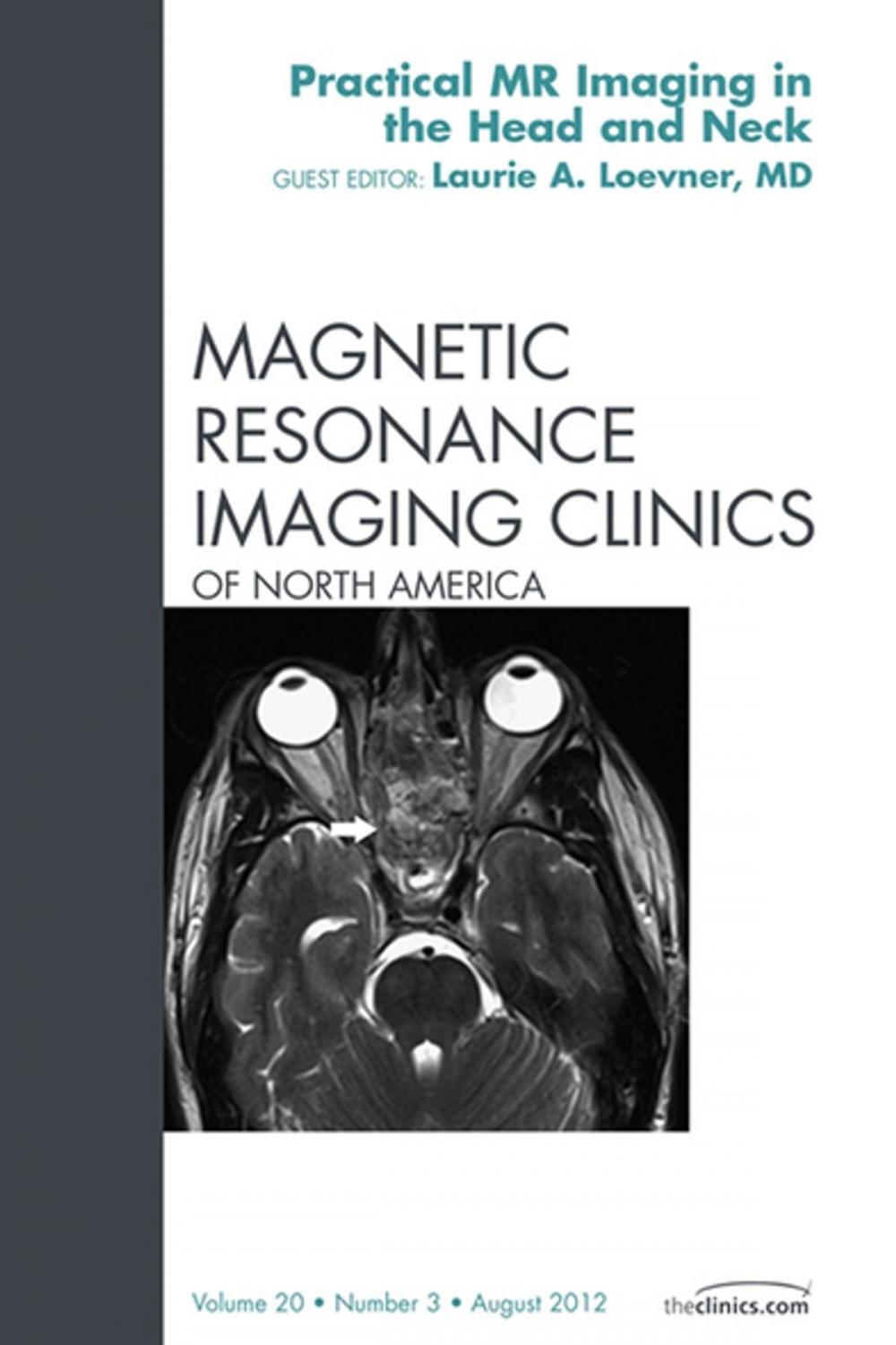 Big bigCover of Head and Neck MRI, An Issue of Magnetic Resonance Imaging Clinics - E-Book