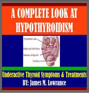 Cover of the book A Complete Look at Hypothyroidism by James Lowrance