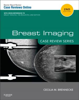 Cover of the book Breast Imaging: Case Review Series E-Book by Ian M. Symonds, MB BS MMedSci DM FRCOG FRANZCOG, Sabaratnam Arulkumaran, PhD DSc FRCSE FRCOG FRANZCOG (Hon)