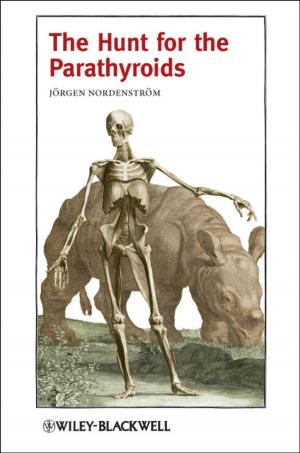Cover of the book The Hunt for the Parathyroids by Jose M. de la Rosa, Rocio del Rio