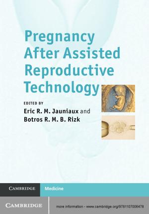 Cover of the book Pregnancy After Assisted Reproductive Technology by Gregory K. Golden