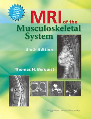Book cover of MRI of the Musculoskeletal System