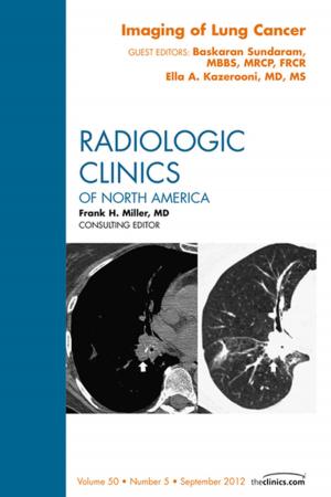 bigCover of the book Imaging of Lung Cancer, An Issue of Radiologic Clinics of North America - E-Book by 
