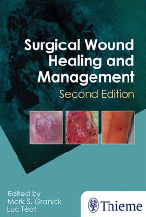 Cover of the book Surgical Wound Healing and Management by Uwe Fischer, Friedemann Baum, Susanne Luftner-Nagel