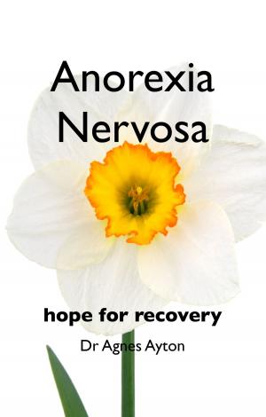 Cover of the book Anorexia Nervosa by Mary Jordan