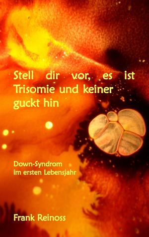 Cover of the book Stell dir vor es ist Trisomie und keiner guckt hin by Manuel Reichstein