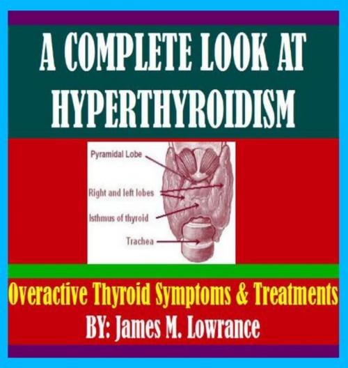 Cover of the book A Complete Look at Hyperthyroidism by James Lowrance, James M. Lowrance