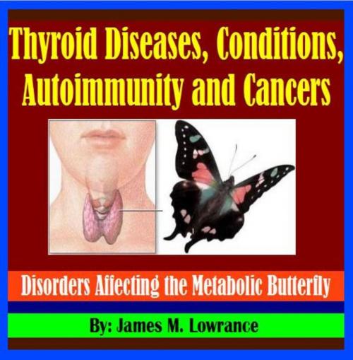 Cover of the book Thyroid Diseases, Conditions, Autoimmunity and Cancers by James Lowrance, James M. Lowrance