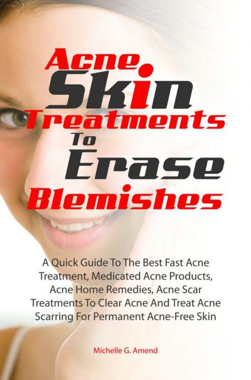 Cover of the book Acne Skin Treatments To Erase Acne Blemishes by Michelle G. Amend, KMS Publishing