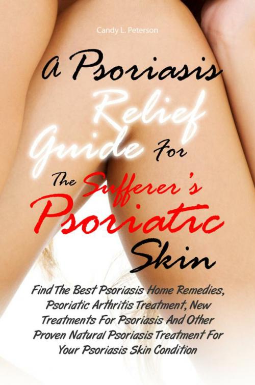 Cover of the book A Psoriasis Relief Guide For The Sufferer’s Psoriatic Skin by Candy L. Peterson, KMS Publishing