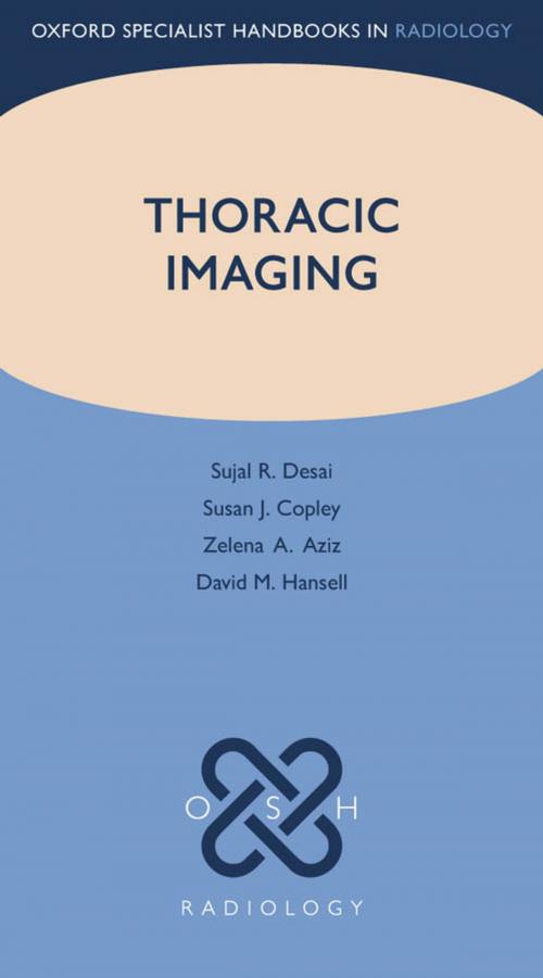 Cover of the book Thoracic Imaging by Sujal R. Desai, Susan J. Copley, Zelena A. Aziz, David M. Hansell, OUP Oxford