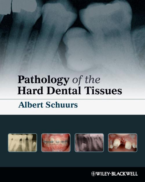 Cover of the book Pathology of the Hard Dental Tissues by Albert Schuurs, Wiley