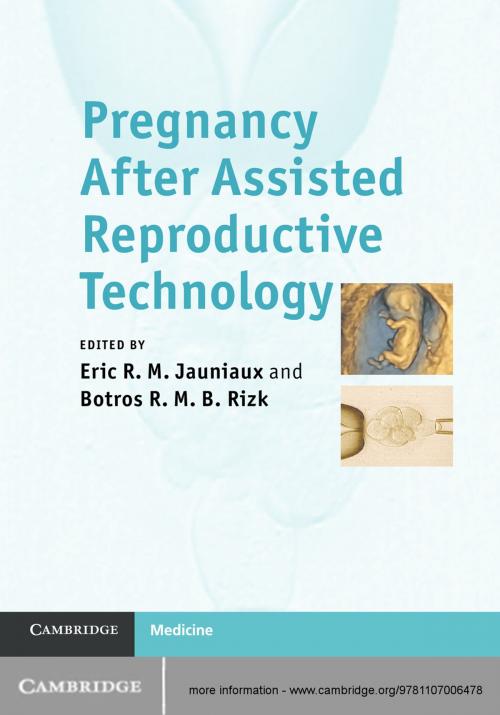 Cover of the book Pregnancy After Assisted Reproductive Technology by , Cambridge University Press