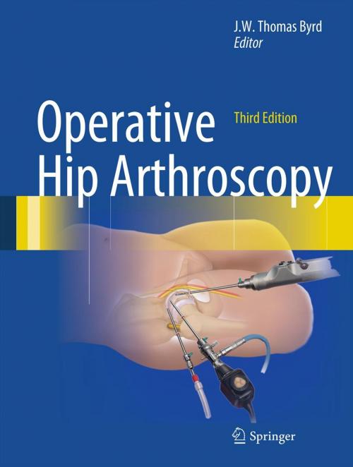 Cover of the book Operative Hip Arthroscopy by , Springer New York