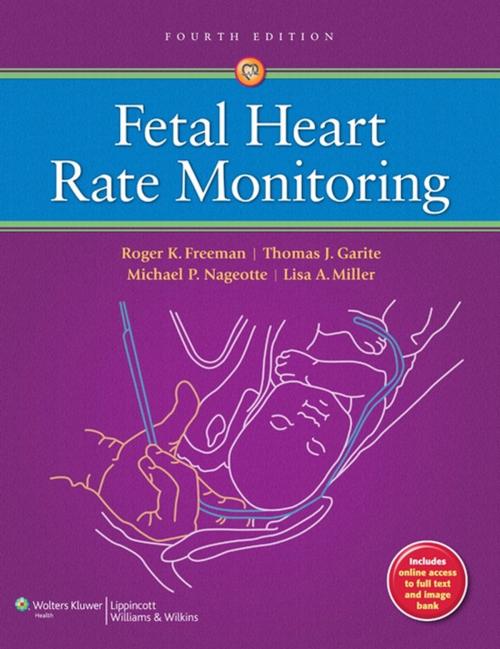 Cover of the book Fetal Heart Rate Monitoring by Roger K. Freeman, Thomas J. Garite, Michael P. Nageotte, Lisa A. Miller, Wolters Kluwer Health