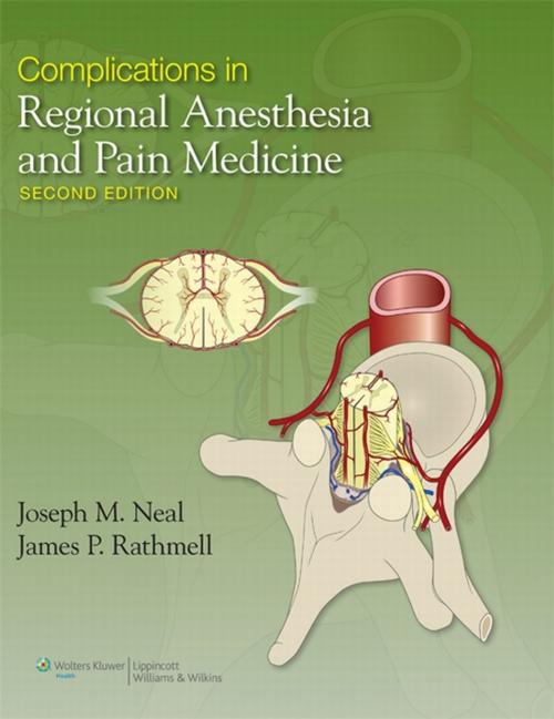 Cover of the book Complications in Regional Anesthesia and Pain Medicine by Joseph Neal, James P. Rathmell, Wolters Kluwer Health