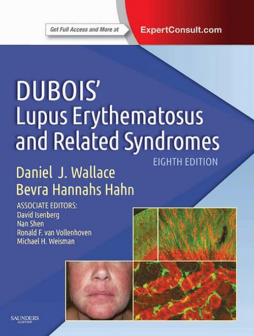 Cover of the book Dubois' Lupus Erythematosus and Related Syndromes E-Book by Bevra Hannahs Hahn, MD, Daniel Wallace, MD, FAAP, FACR, Elsevier Health Sciences