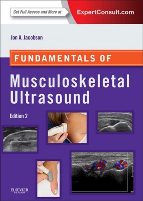Cover of the book Fundamentals of Musculoskeletal Ultrasound by Jon A. Jacobson, Elsevier Health Sciences