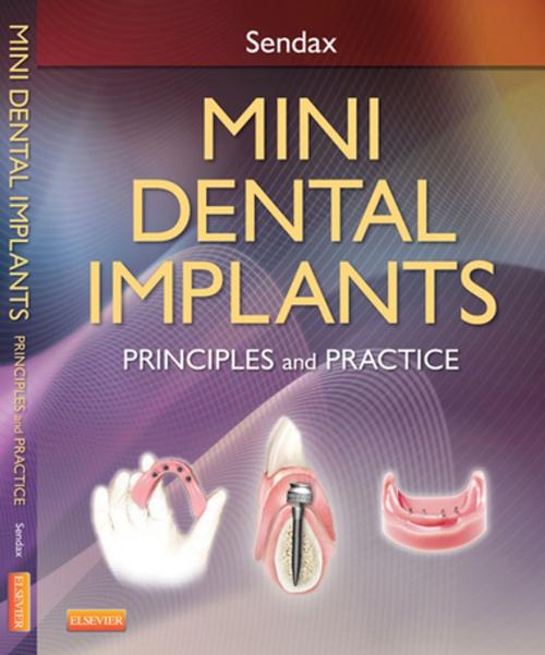 Cover of the book Mini Dental Implants - E-Book by Victor Dr. Sendax, Elsevier Health Sciences