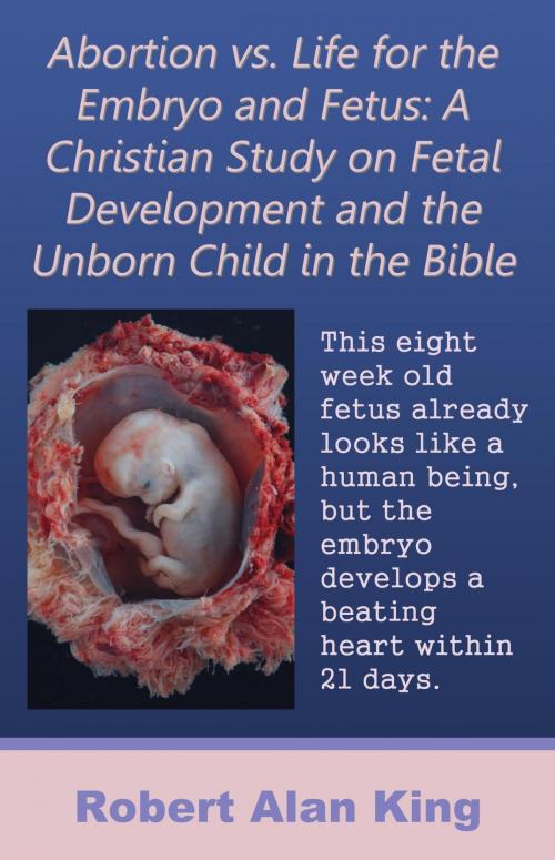 Cover of the book Abortion vs. Life for the Embryo and Fetus: A Christian Study on Fetal Development and the Unborn Child in the Bible by Robert Alan King, Robert Alan King
