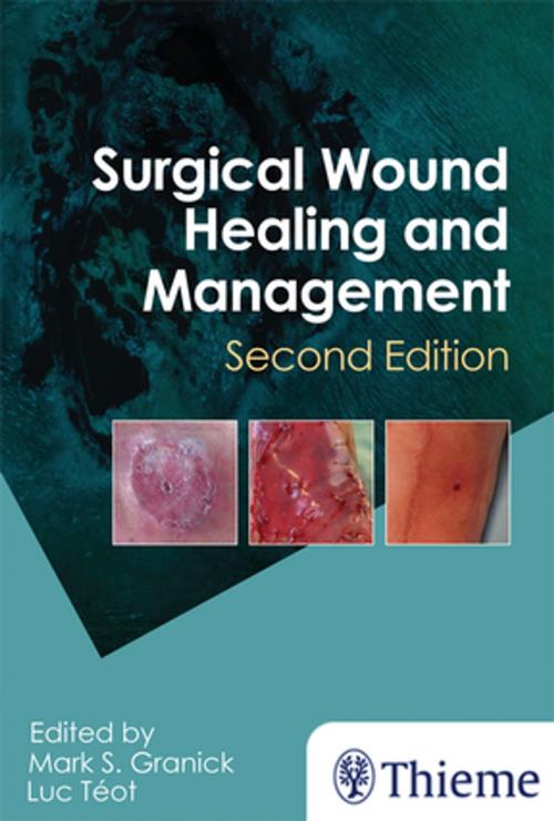 Cover of the book Surgical Wound Healing and Management by , Thieme