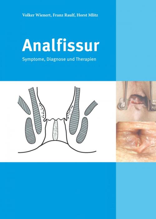 Cover of the book Analfissur by Franz Raulf, Prof. Dr. med. Volker Wienert, Dr. med. Horst Mlitz, epubli