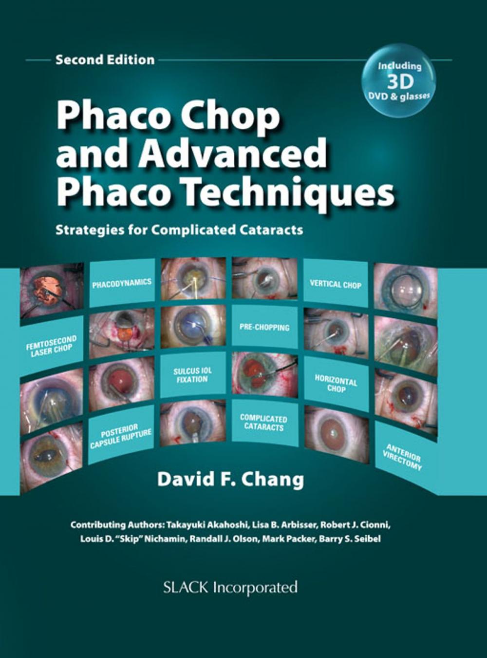 Big bigCover of Phaco Chop and Advanced Phaco Techniques