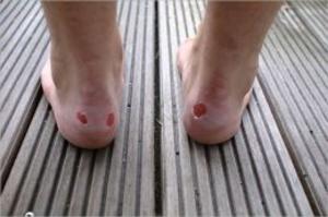 Cover of the book How To Get Rid of Blisters by Willis Toenjes