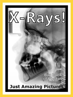 Book cover of Just X-Ray Photos! Big Book of Photographs & Pictures of X-Rays, Medical Xray, Hospital Xrays, Vol. 1