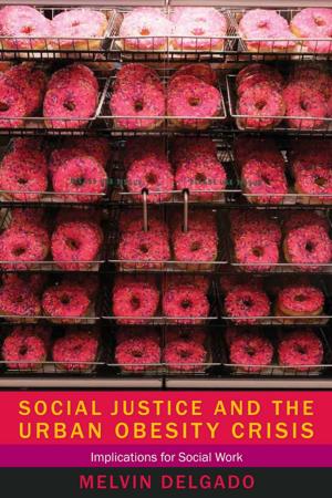 Book cover of Social Justice and the Urban Obesity Crisis